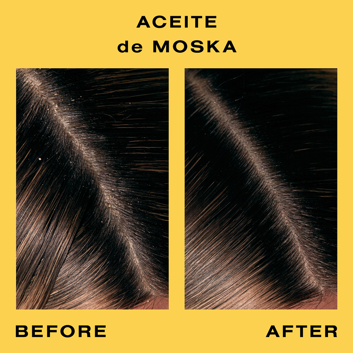 Ceremonia - Aceite de Moska Scalp Oil